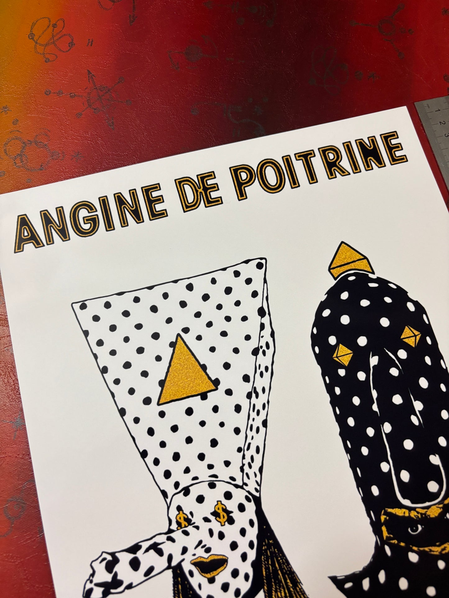 ANGINE DE POITRINE - Symbios Design Rare Glossy Poster Print